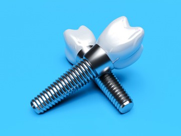 Closeup of two dental implants in Norwood on a blue background