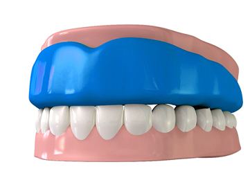 Model of an athletic mouthguard protecting the teeth.