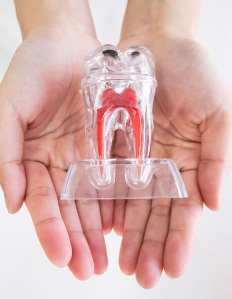 Hand holding a model of a tooth