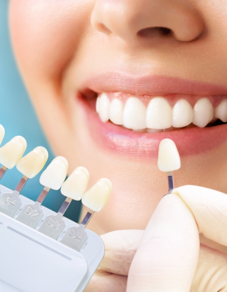 woman in red shirt trying on veneers in dental chair 