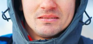 Man wearing a coat with chapped lips