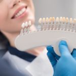 porcelain veneers to fix small teeth