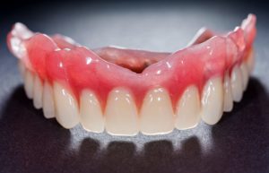 Upper denture for missing teeth