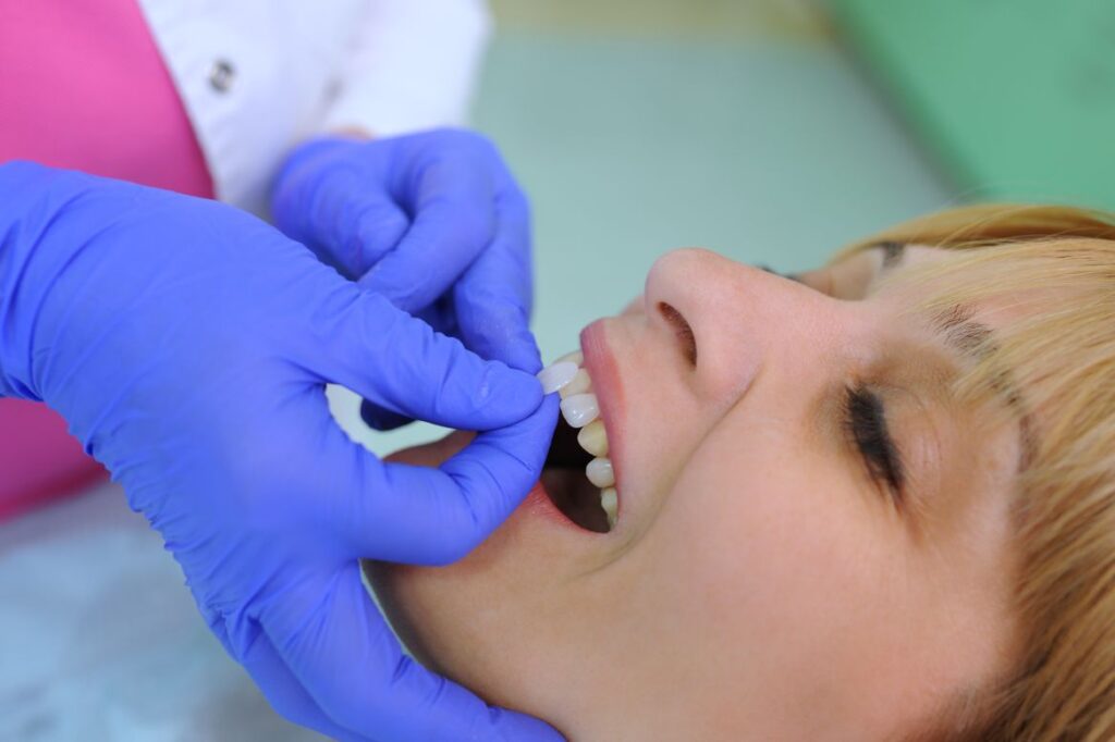 A dentist applying veneers to a woman’s teeth